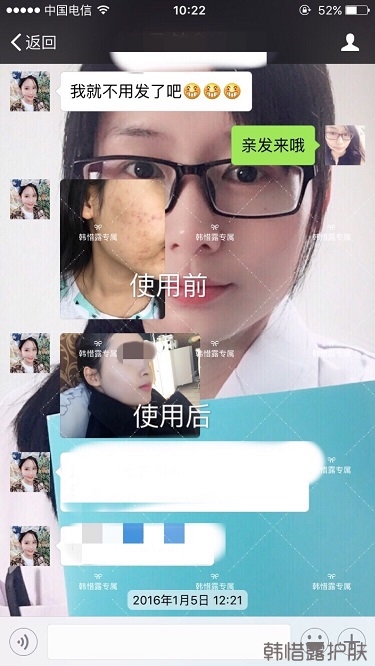 痘花妹变无暇美女