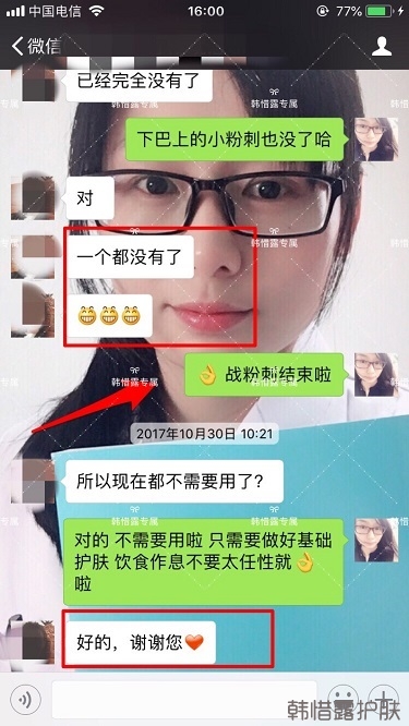 粉刺密密麻麻，试过很多方法无果后找韩惜露老师轻松去掉粉刺！