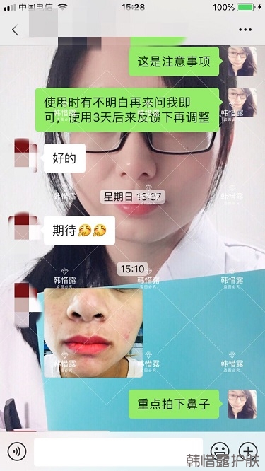 鼻子发红长痘痘消了，皮肤吸收好就是任性！