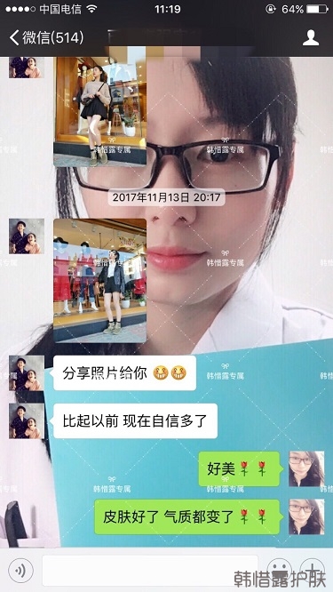 脸上长痘痘怎么去掉？彻底告别痘痘，自卑到自信的蜕变！