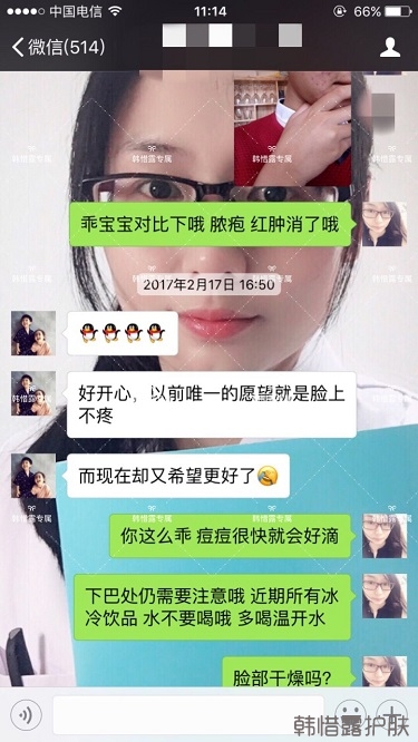 脸上长痘痘怎么去掉？彻底告别痘痘，自卑到自信的蜕变！