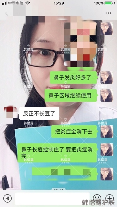 鼻子发红长痘痘消了，皮肤吸收好就是任性！