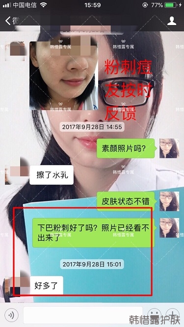 粉刺密密麻麻，试过很多方法无果后找韩惜露老师轻松去掉粉刺！