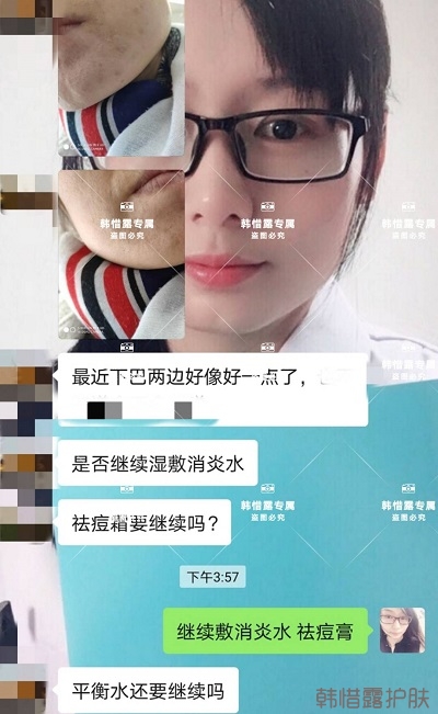 怎么消除脸上的痘痘，发硬脓包消下去了