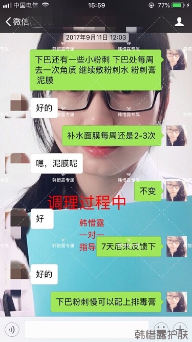 粉刺密密麻麻，试过很多方法无果后找韩惜露老师轻松去掉粉刺！